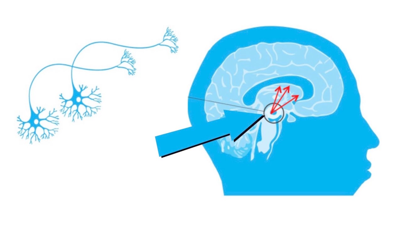 Terapia genetica GDNF Parkinson